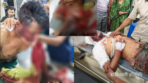 Attempted Murder of Jubo League Leader in Feni; Victim Hospitalized in Critical Condition